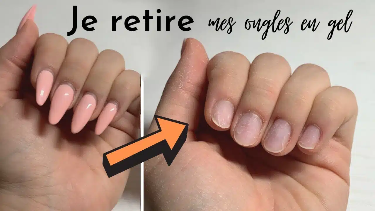 enlever des faux ongles
